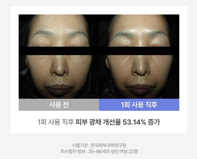 IIDAYA DERMA THERAPY Pure Essential Eye Oil (30ml)